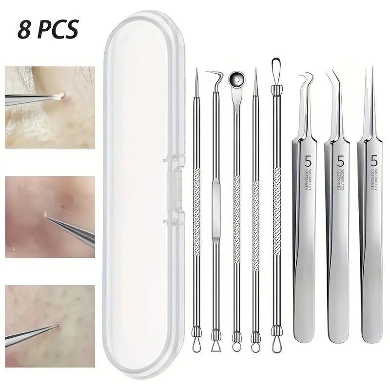 Blackhead Remover Kit – 8-Piece Stainless Steel